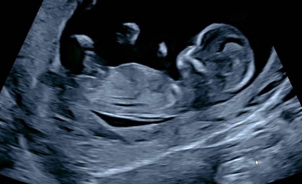 Baby or family photo placeholder